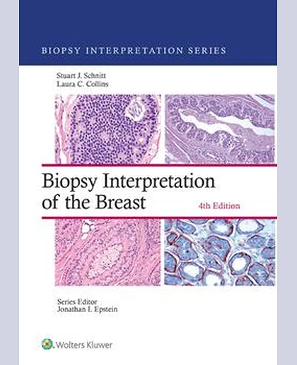 Biopsy Interpretation of the Breast