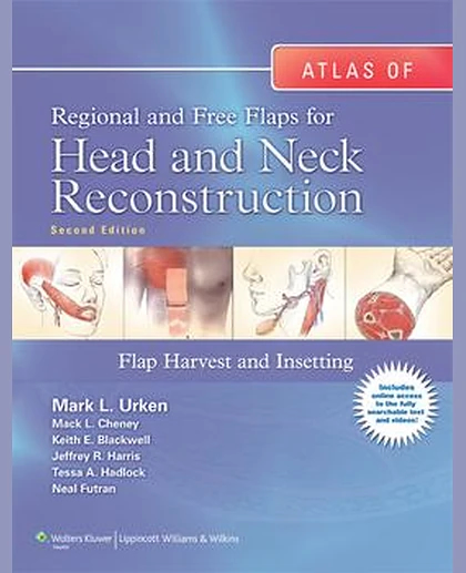 Atlas of Regional and Free Flaps for Head and Neck Reconstruction