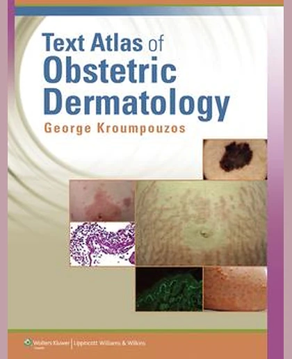 Text Atlas of Obstetric Dermatology