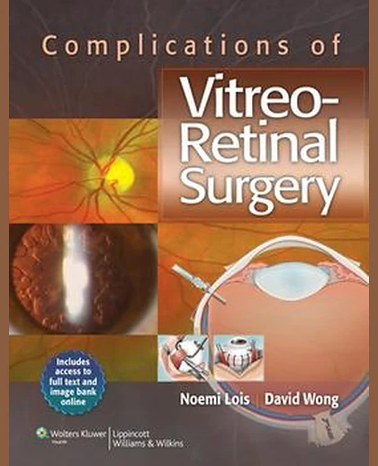 Complications of Vitreo-Retinal Surgery