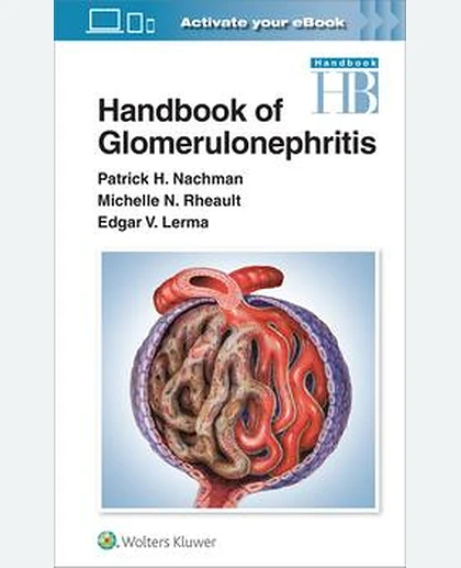 Handbook of Glomerulonephritis