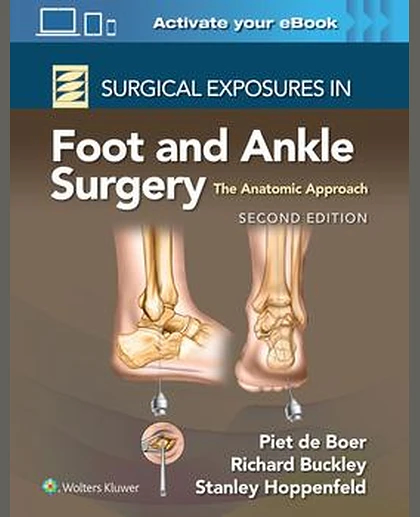 Surgical Exposures in Foot and Ankle Surgery: The Anatomic Approach