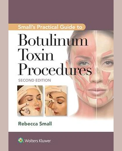 Small's Practical Guide to Botulinum Toxin Procedures
