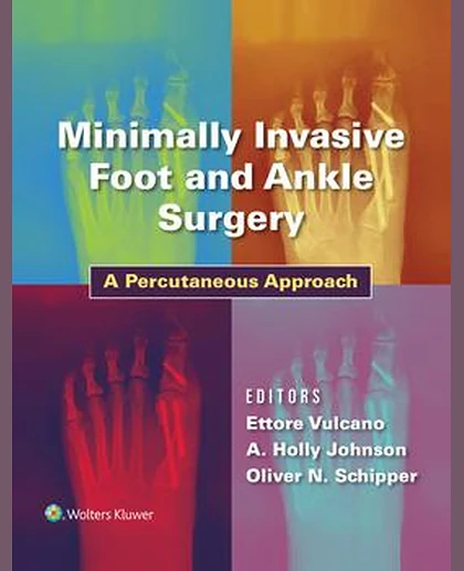 Minimally Invasive Foot and Ankle Surgery