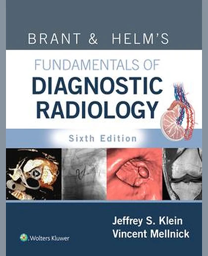 Brant & Helms' Fundamentals of Diagnostic Radiology, 6e Multi Vol