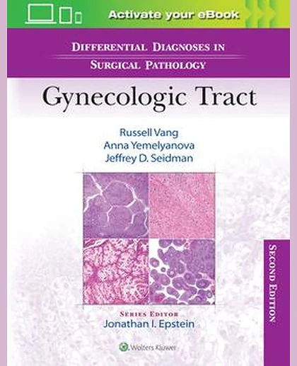 Differential Diagnoses in Surgical Pathology: Gynecologic Tract