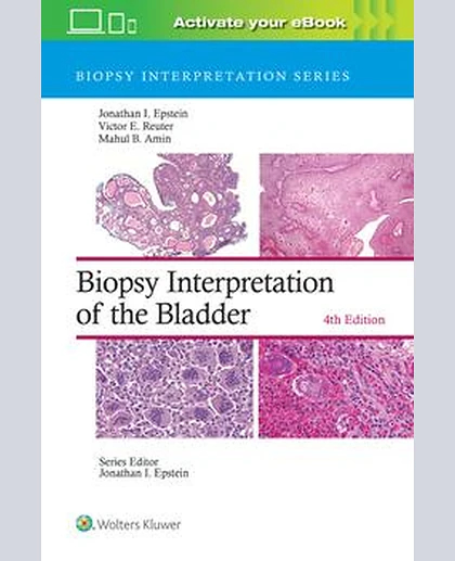 Biopsy Interpretation of the Bladder