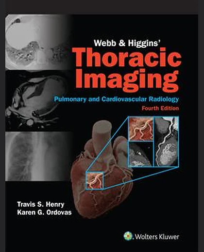 Webb & Higgins Thoracic Imaging