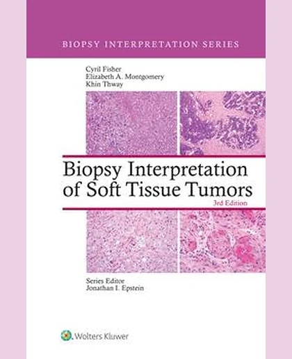 Biopsy Interpretation of Soft Tissue Tumors