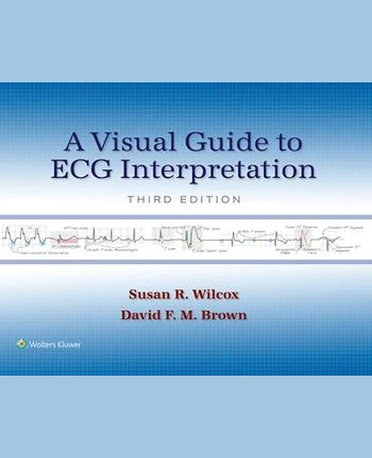 A Visual Guide to ECG Interpretation
