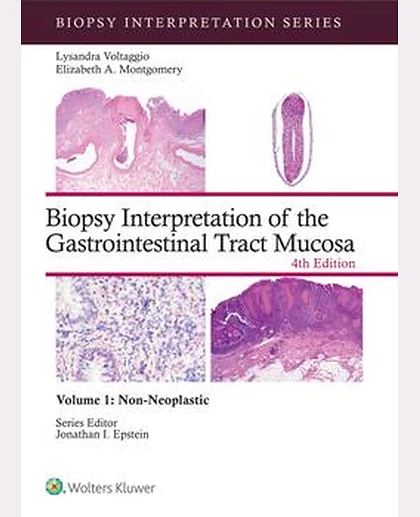 Biopsy Interpretation of the Gastrointestinal Tract Mucosa Volume 1
