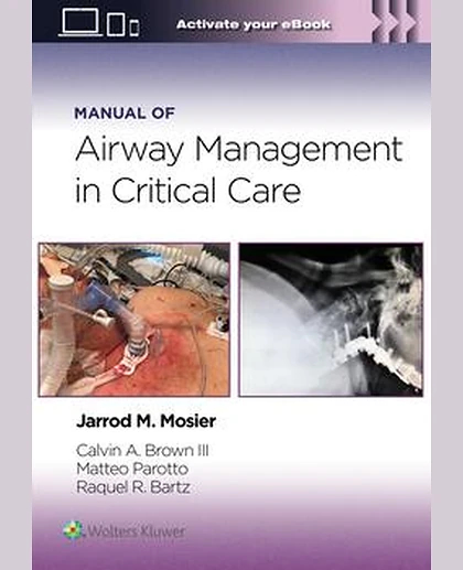 Manual of Airway Management in Critical Care