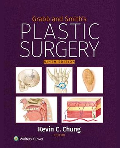 Grabb and Smith's Plastic Surgery