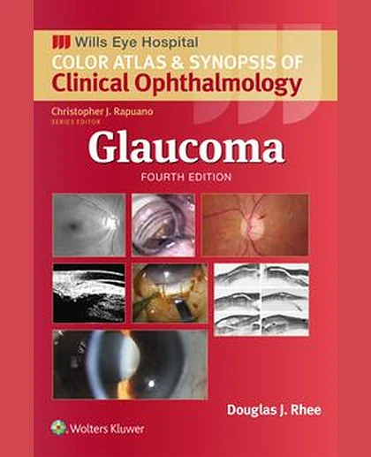 Glaucoma