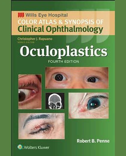 Oculoplastics