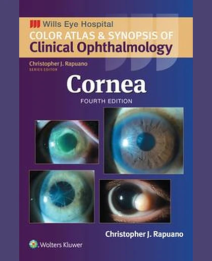 Cornea