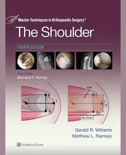 Master Techniques in Orthopaedic Surgery: The Shoulder