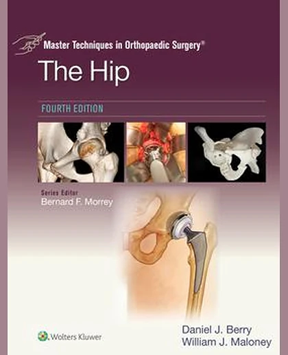 Master Techniques in Orthopaedic Surgery: The Hip