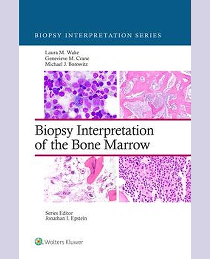 Biopsy Interpretation of the Bone Marrow