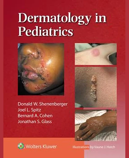 Dermatology in Pediatrics