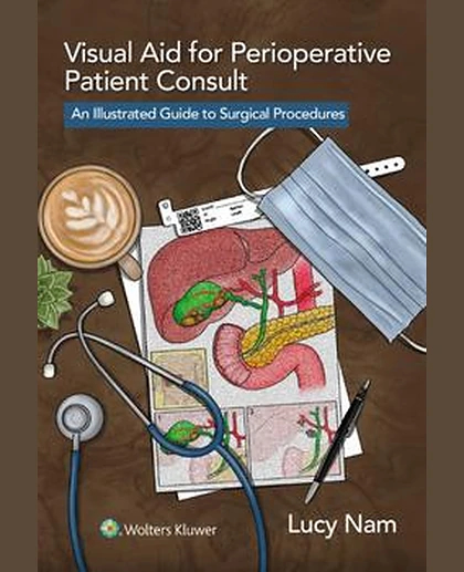 Visual Aid for Perioperative Patient Consult