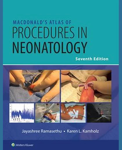 MacDonald’s Atlas of Procedures in Neonatology