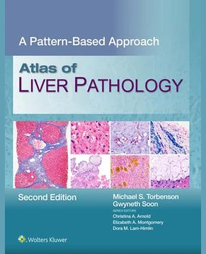 Atlas of Liver Pathology