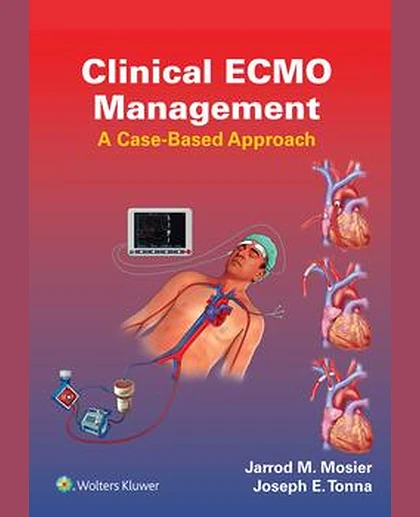Clinical ECMO Management