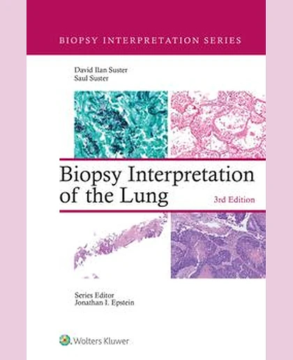 Biopsy Interpretation of the Lung