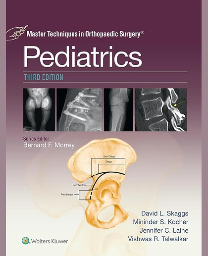 Master Techniques in Orthopaedic Surgery: Pediatrics