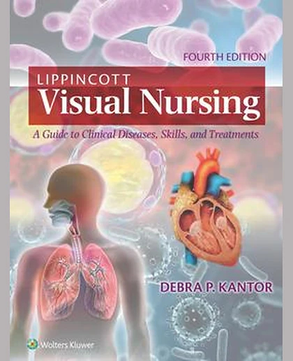 Lippincott Visual Nursing