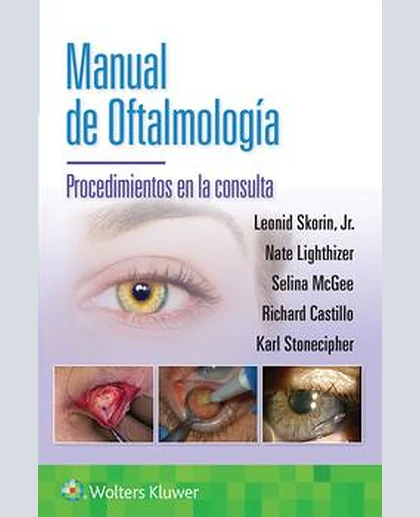 Manual de oftalmología. Procedimientos en la consulta