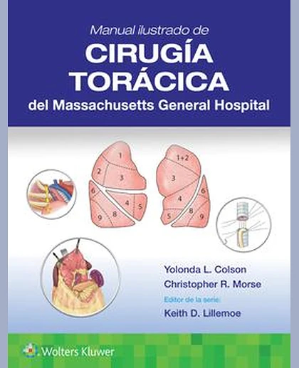 Manual ilustrado de Cirugía torácica del Massachusetts General Hospital