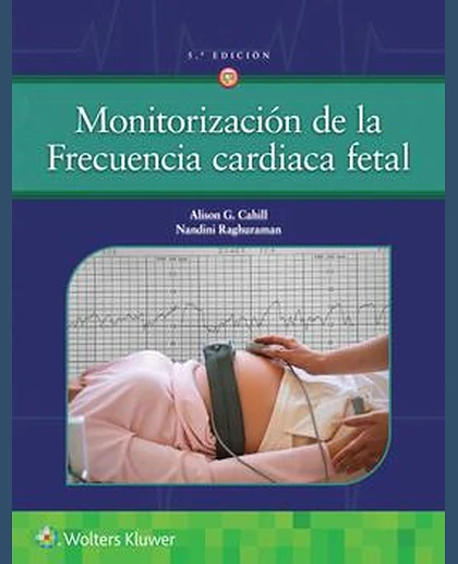 Monitorización de la frecuencia cardiaca fetal