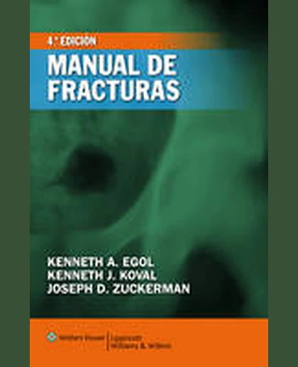 Manual de fracturas