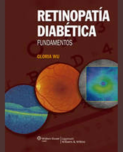 Retinopatía diabética: fundamentos