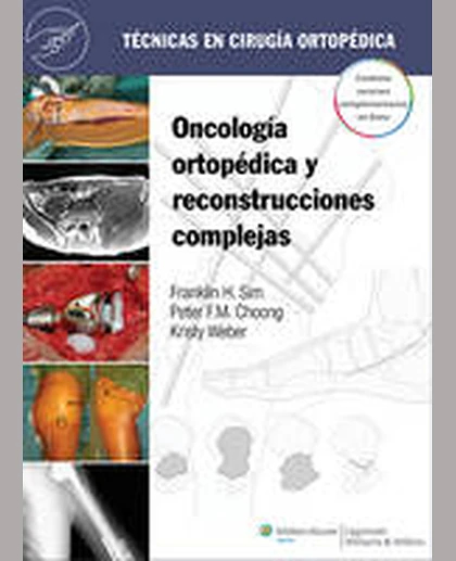 Oncología ortopédica y reconstrucciones complejas