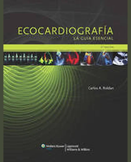 Ecocardiografía: la guía esencial