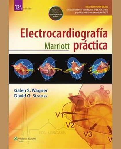 Marriott. Electrocardiografía práctica