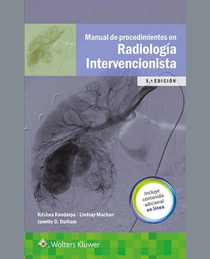 Manual de procedimientos en radiología intervencionista