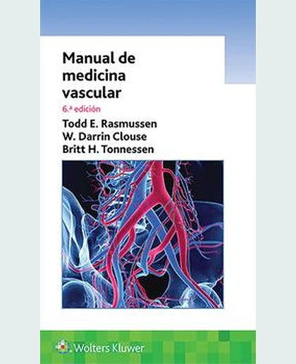 Manual de medicina vascular