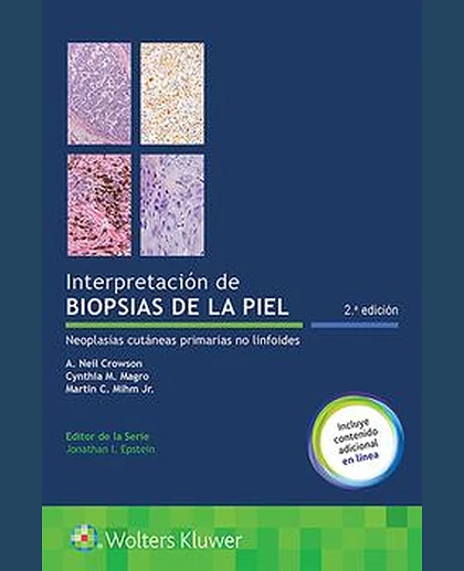 Interpretación de biopsias de la piel
