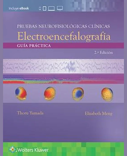 Pruebas neurofisiológicas clínicas. Electroencefalografía
