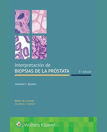 Interpretación de biopsias de la próstata