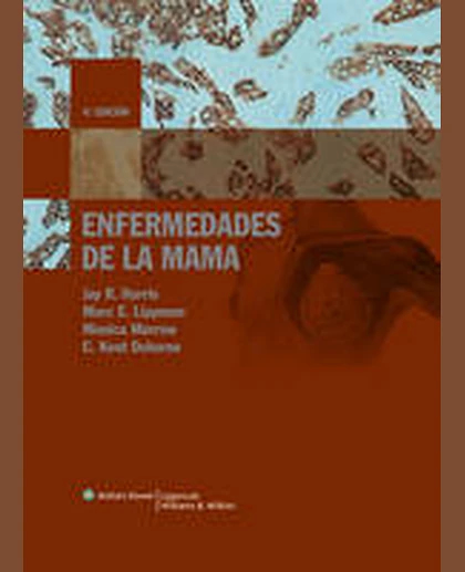 Enfermedades de la mama