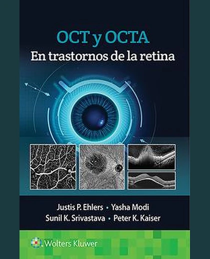 OCT y OCTA en trastornos de la retina