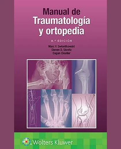 Manual de traumatología y ortopedia