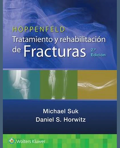 Hoppenfeld. Tratamiento y rehabilitación de fracturas