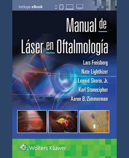 Manual de láser en oftalmología