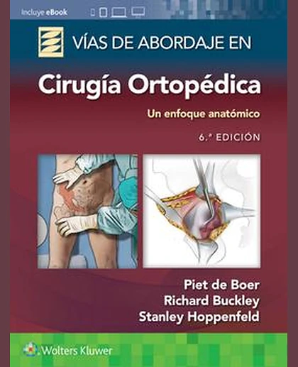 Vías de abordaje de cirugía ortopédica. Un enfoque anatómico